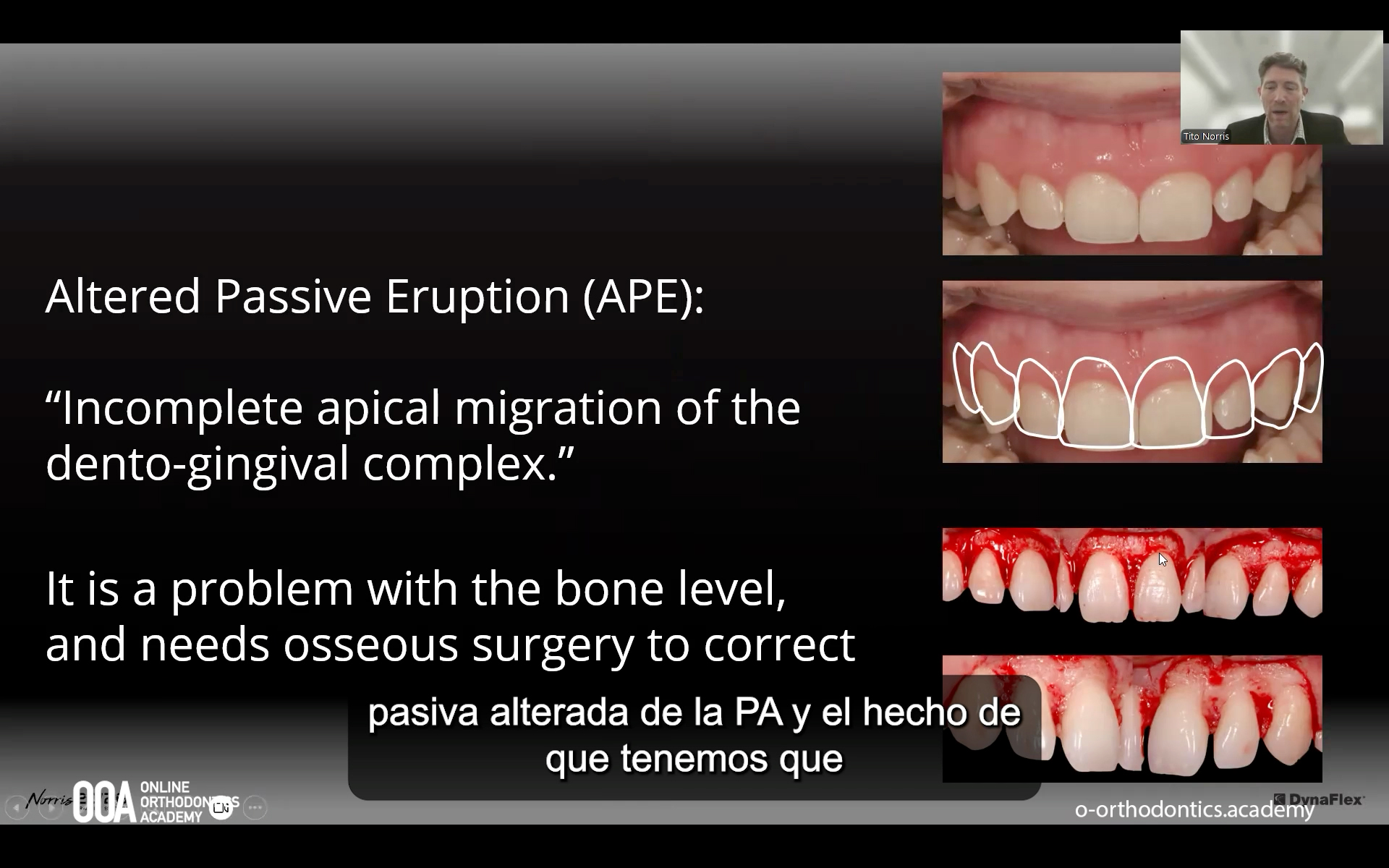 O10-OOA-norris-market-2026-a