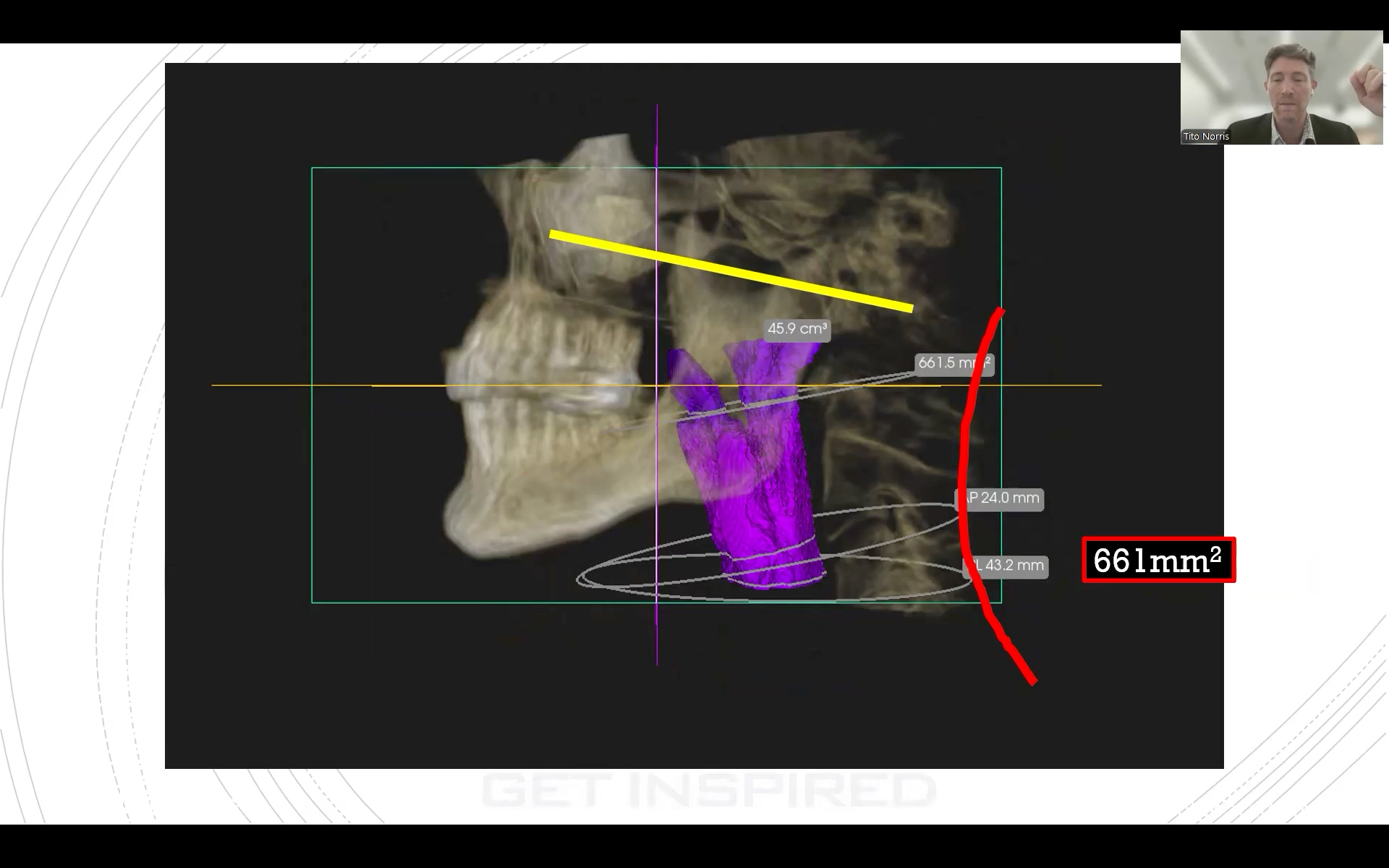 O10-OOA-norris-market-2026-c
