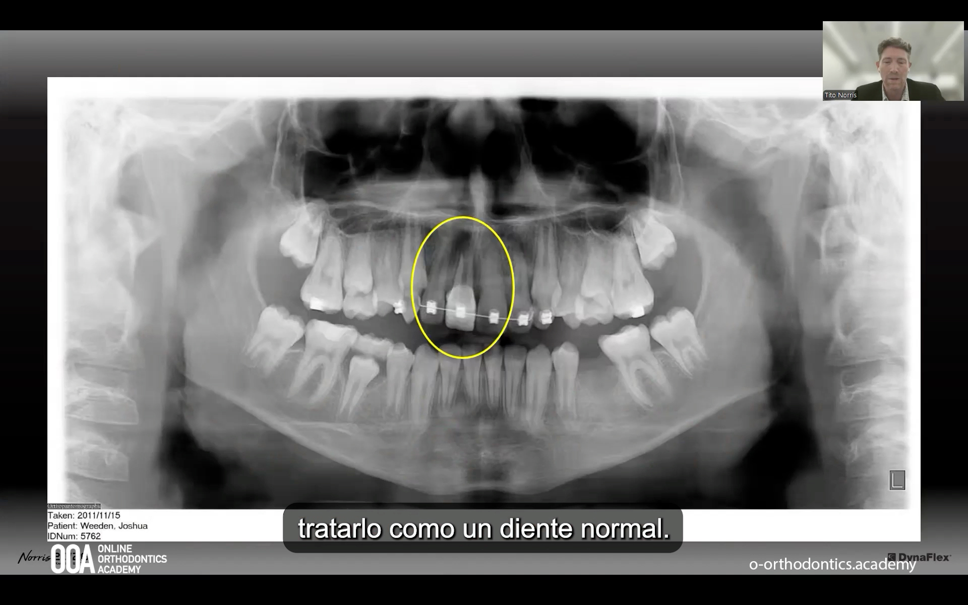 O10-OOA-norris-market-2026-d