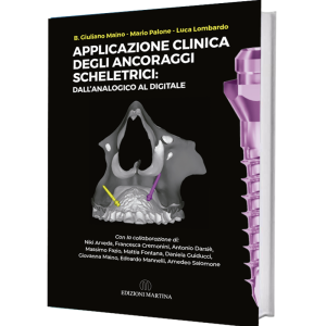 APPLICAZIONE CLINICA DEGLI ANCORAGGI SCHELETRECI: dall'analogico al digitales - B.Giuliano Maino - Mario Palone - Luca Lombardo