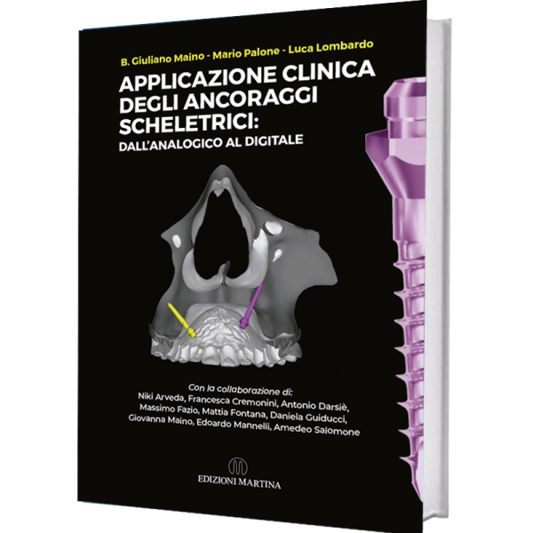 APPLICAZIONE CLINICA DEGLI ANCORAGGI SCHELETRECI: dall'analogico al digitales - B.Giuliano Maino - Mario Palone - Luca Lombardo